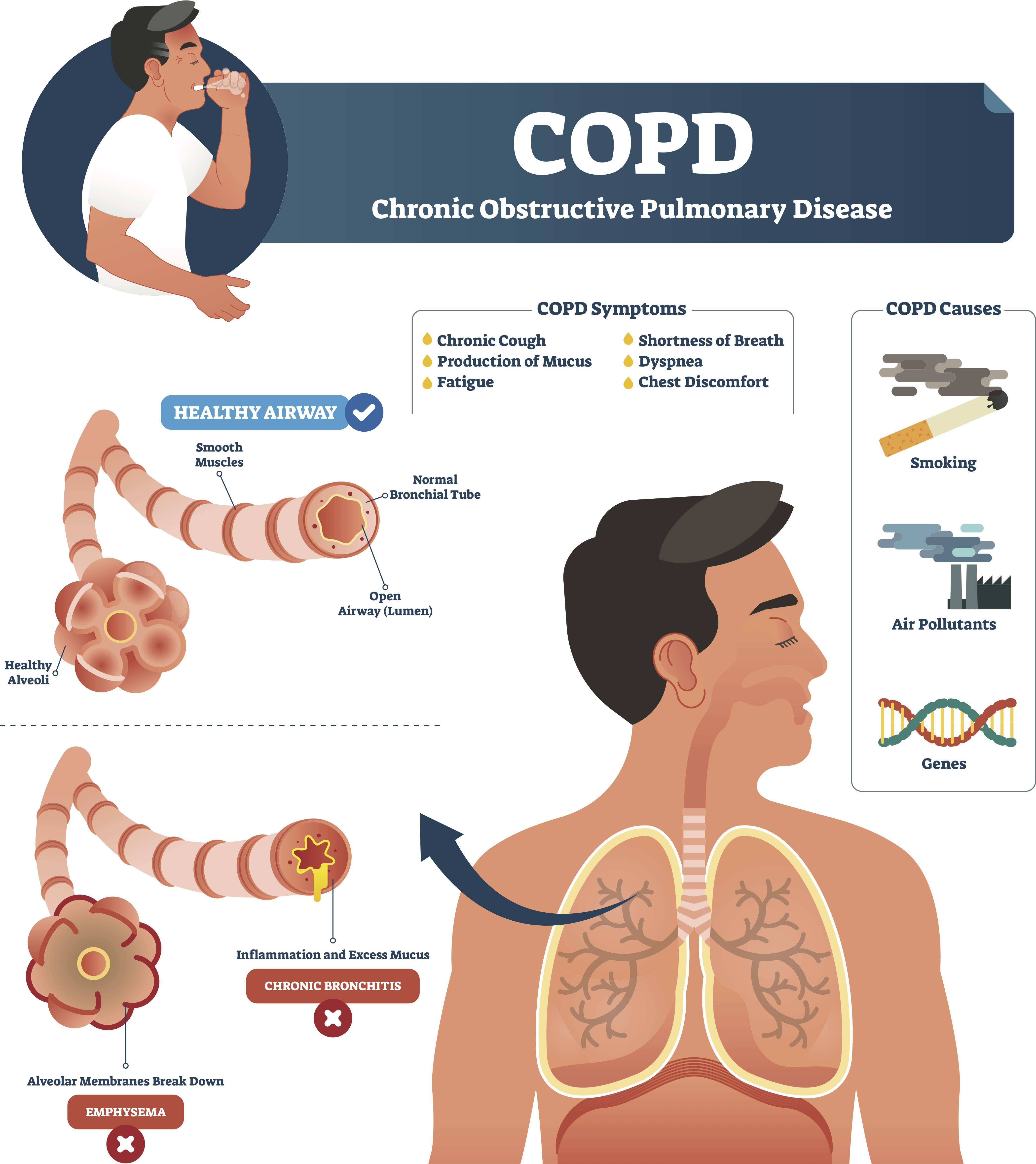 air travel with oxygen copd