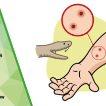 Snake bites